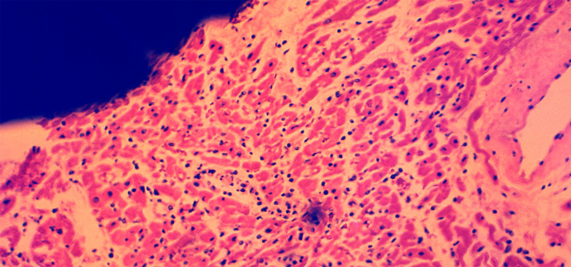 Myocardial tissue